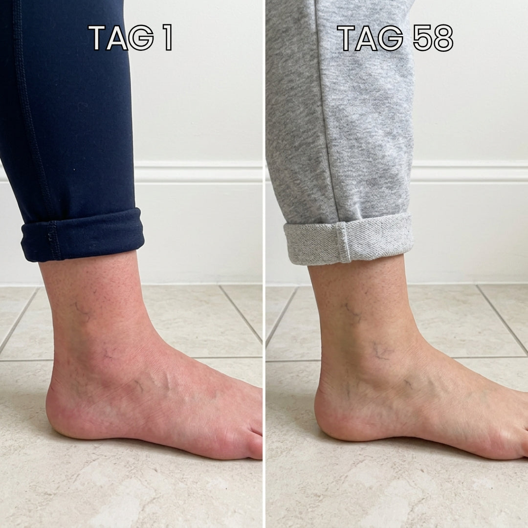 VenoPulse™ EMS-Fußmatte