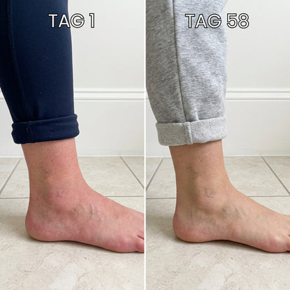 VenoPulse™ EMS-Fußmatte