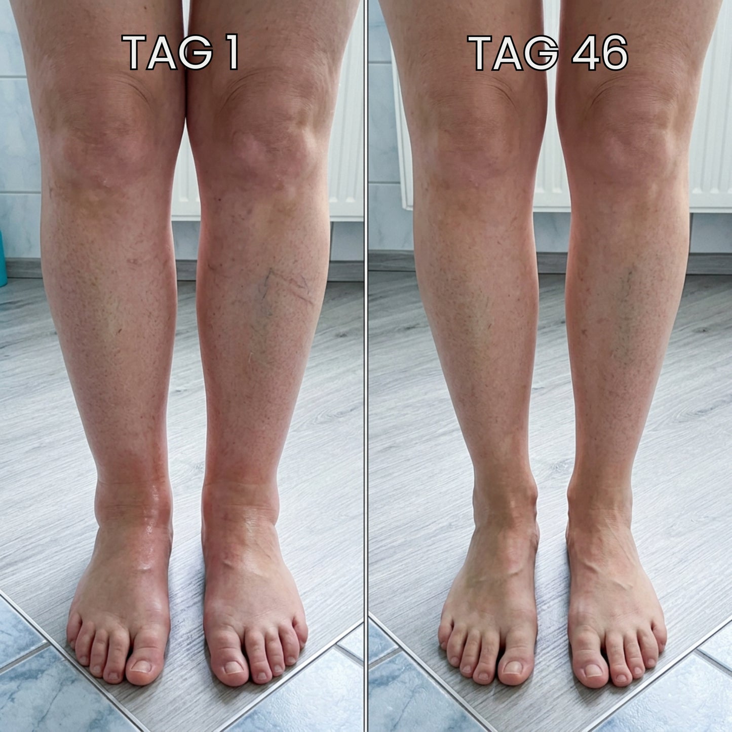 VenoPulse™ EMS-Fußmatte