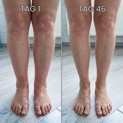 VenoPulse™ EMS-Fußmatte